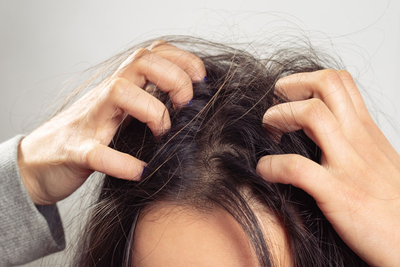 dealing with head lice
